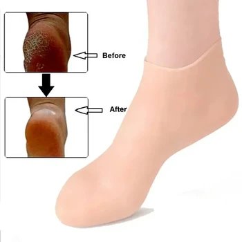Силиконовые носки для спа, увлажняющие гелевые носки, отшелушивающие и предотвращающие сухость, растрескивание омертвевшей кожи, удаляющие защитное средство для ухода за ногами